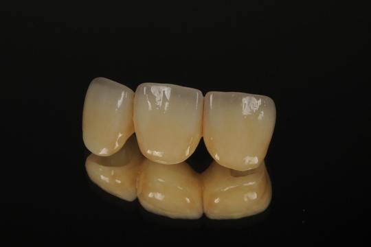 審美歯科治療 - たくぼ歯科クリニック（神戸市西区）